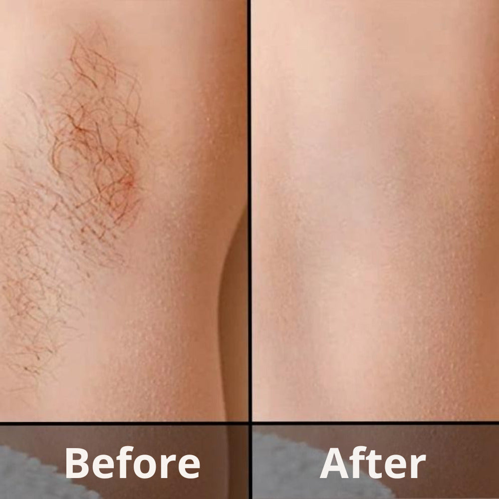 ODYLLA® - IPL HAIR REMOVAL DEVICE