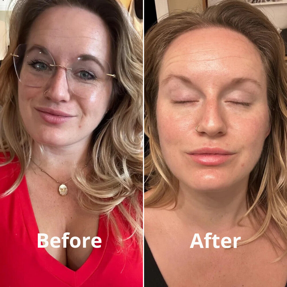 ODYLLA® - COLLAGEN MASK